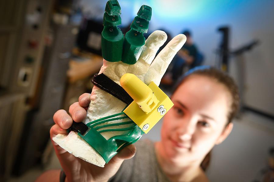 Student with a printed prosthetic